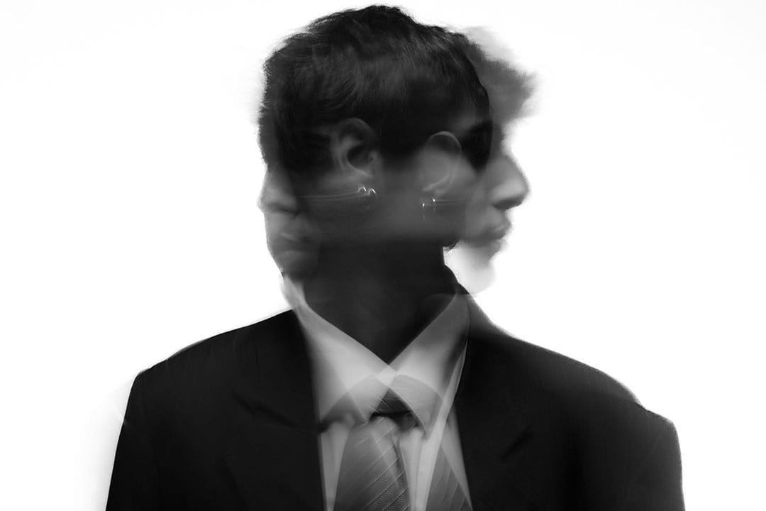 Yamil Quiere Ser Artista sacudiendo la cabeza